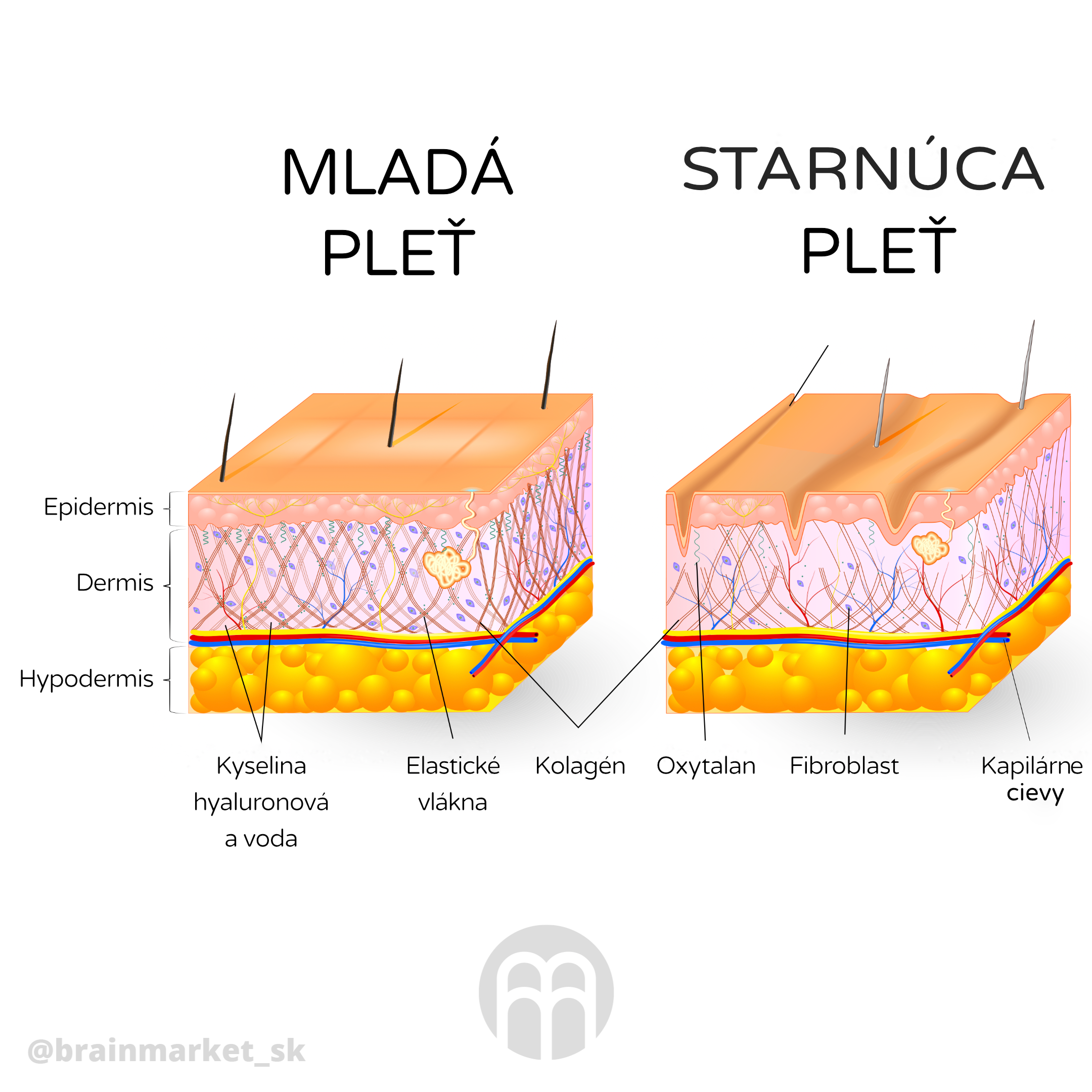 mlada vs stara plet_cz